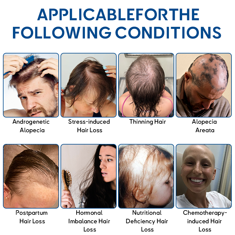 👑Developed by Trichologists: Rolimey® STEM Cell Hair Cycle Roller – Instantly Stops Hair Loss & Promotes Real Regrowth (🔥 Up to 80% OFF)