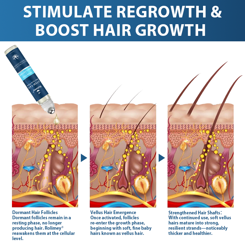 🇬🇧👨‍⚕️Developed by Trichologists: 𝐑𝐨𝐥𝐢𝐦𝐞𝐲® 𝐒𝐓𝐄𝐌 𝐂𝐞𝐥𝐥 𝐇𝐚𝐢𝐫 𝐂𝐲𝐜𝐥𝐞 𝐑𝐨𝐥𝐥𝐞𝐫 – Instantly Stops Hair Loss & Promotes Real Regrowth (🔥LAST DAY 80% OFF)
