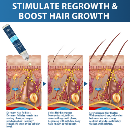🇬🇧👨‍⚕️Developed by Trichologists: 𝐑𝐨𝐥𝐢𝐦𝐞𝐲® 𝐒𝐓𝐄𝐌 𝐂𝐞𝐥𝐥 𝐇𝐚𝐢𝐫 𝐂𝐲𝐜𝐥𝐞 𝐑𝐨𝐥𝐥𝐞𝐫 – Instantly Stops Hair Loss & Promotes Real Regrowth (🔥LAST DAY 80% OFF)