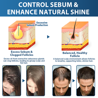 🇬🇧👨‍⚕️Developed by Trichologists: 𝐑𝐨𝐥𝐢𝐦𝐞𝐲® 𝐒𝐓𝐄𝐌 𝐂𝐞𝐥𝐥 𝐇𝐚𝐢𝐫 𝐂𝐲𝐜𝐥𝐞 𝐑𝐨𝐥𝐥𝐞𝐫 – Instantly Stops Hair Loss & Promotes Real Regrowth (🔥LAST DAY 80% OFF)