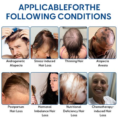 👑Developed by Trichologists: Rolimey® STEM Cell Hair Cycle Roller – Instantly Stops Hair Loss & Promotes Real Regrowth (🔥 Up to 80% OFF)