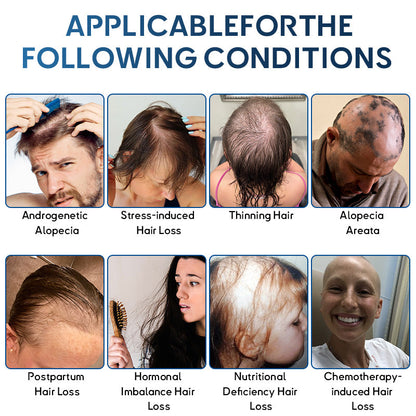 🇬🇧👨‍⚕️Developed by Trichologists: 𝐑𝐨𝐥𝐢𝐦𝐞𝐲® 𝐒𝐓𝐄𝐌 𝐂𝐞𝐥𝐥 𝐇𝐚𝐢𝐫 𝐂𝐲𝐜𝐥𝐞 𝐑𝐨𝐥𝐥𝐞𝐫 – Instantly Stops Hair Loss & Promotes Real Regrowth (🔥LAST DAY 80% OFF)